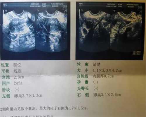 广州代孕哪家专业,试管婴儿是怎么来的_广州有供精gong卵_上海供卵试管生子多