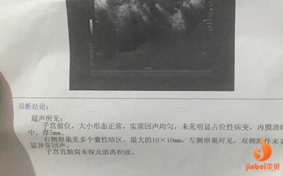 广州代孕包成功价钱,【广州哪家医院可以做供卵试管婴儿】医生询问以前有没