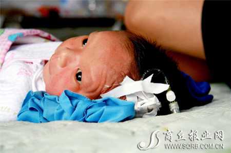 北京代孕早期出血会导致流产吗？