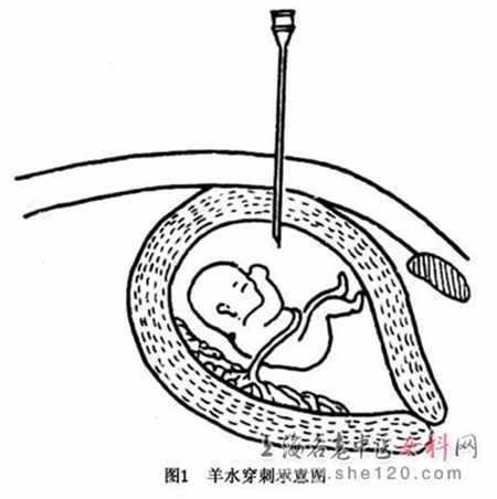 北京代孕一个月肚子会痛吗