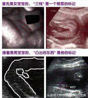 广州代孕植入试管婴儿过程_广州代孕多少钱代一个