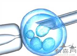 切除子宫又怀孕了_胎停查染色体异常_武汉协和医院39岁多囊卵巢症试管婴儿多