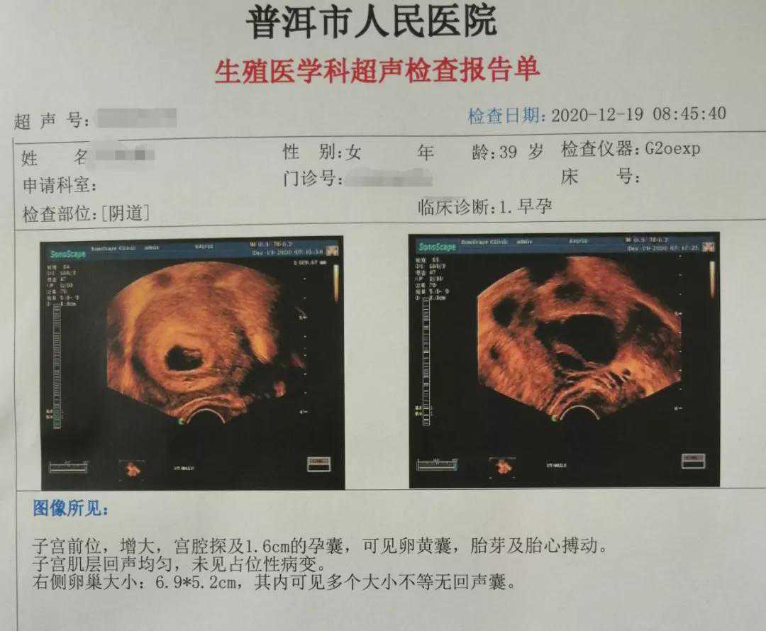 广州哪里代孕成功率高价格低_2022普洱人民医院试管婴儿成功率一览，附试管成